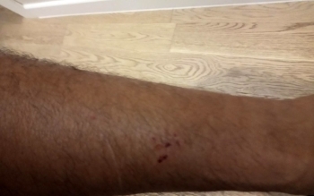 (Özel) Göktürk’Te Köpek Saldırısı Kamerada
