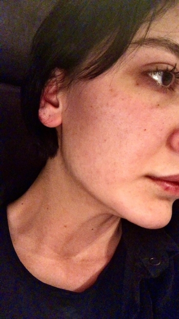 Oyuncu Sevcan Yaşar’In Darp Edilmesine İlişkin Fotoğraflar Dava Dosyasına Girdi
