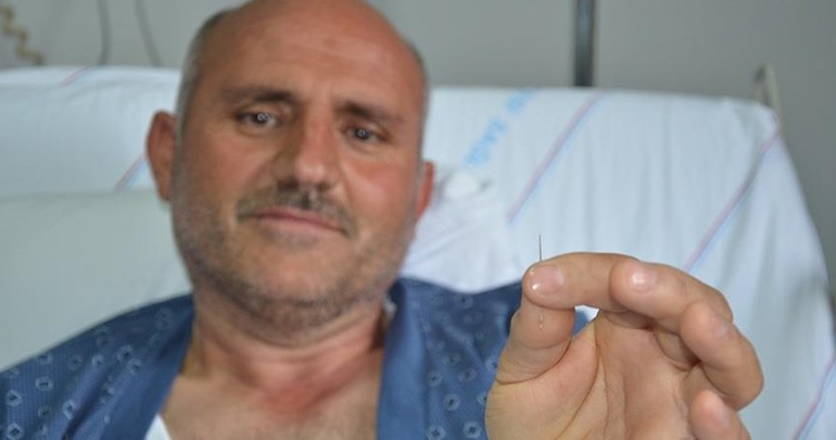 Akciğerinden ‘dikiş iğnesi’ çıktı
