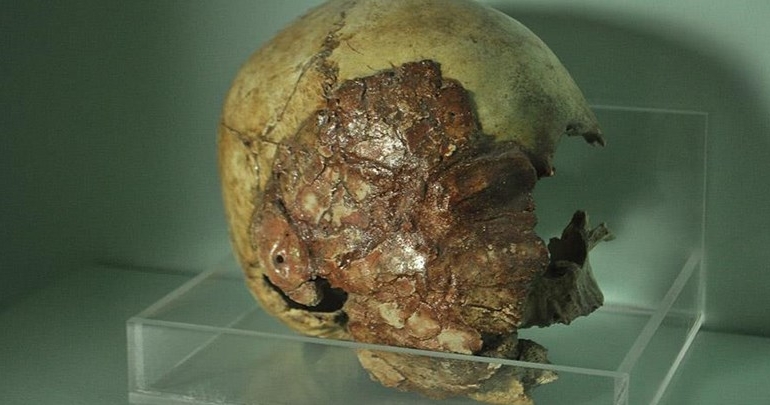 Niğde Müzesi’nde 7 bin 200 yıllık kafatasları sergileniyor